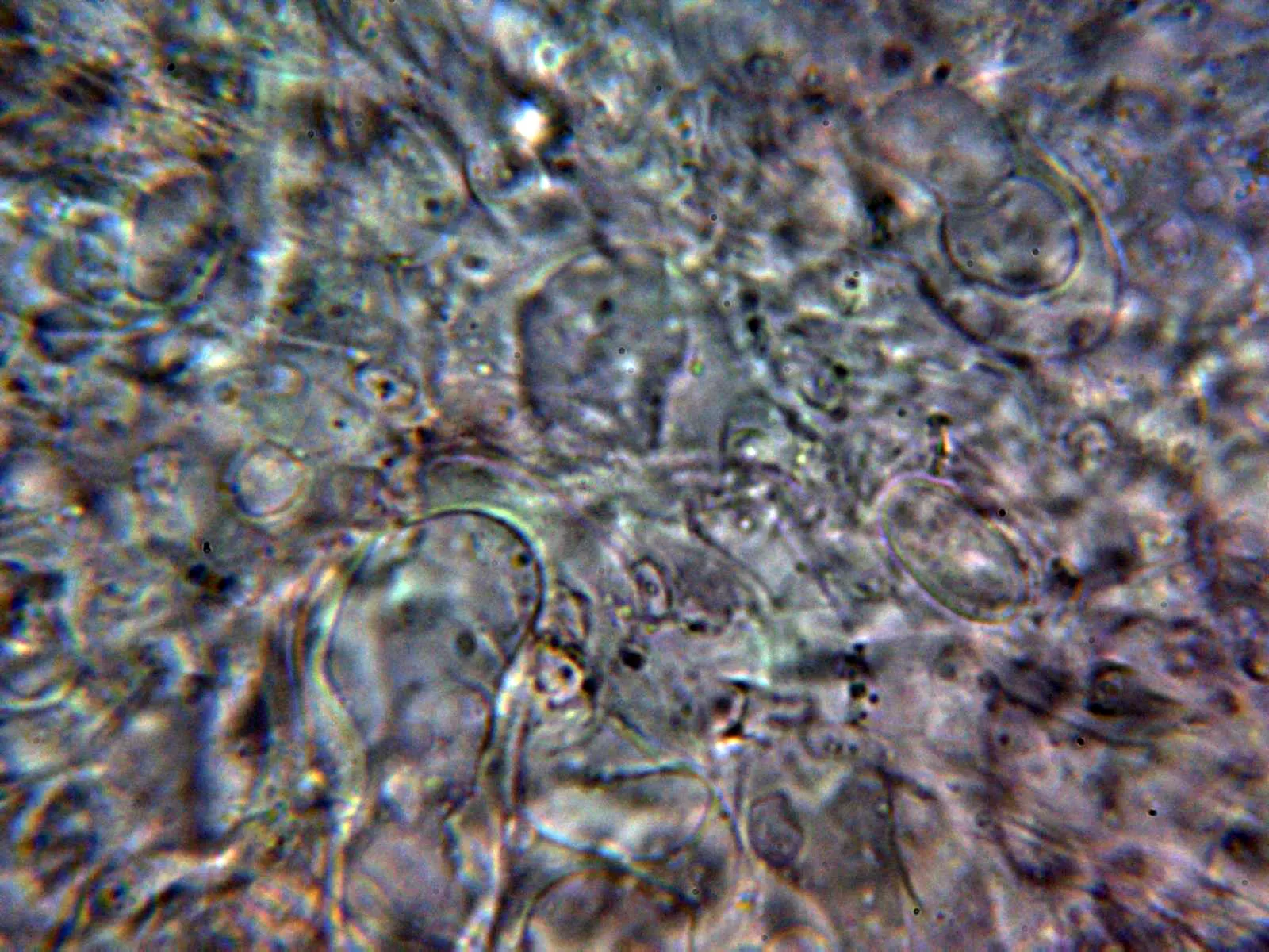 Microscopía de Peziza fimeti - 10 - Excípulo medular